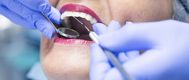 Best Emergency Dental Care for Broken or Chipped Teeth in Hilmar Irwin, CA
